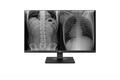 LG TFT LG  Medical 27'' 27HJ713C-B Clinical Review