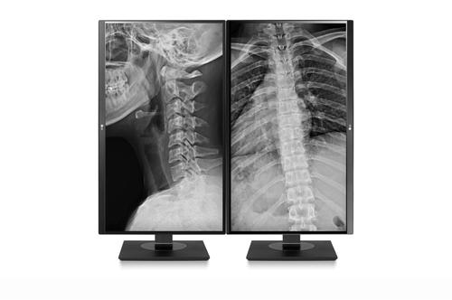 LG TFT LG  Medical 27'' 27HJ713C-B Clinical Review (27HJ713C-B)