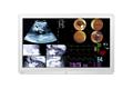 LG TFT LG  Medical 32'' 32HL714S-W Surgical Monitor