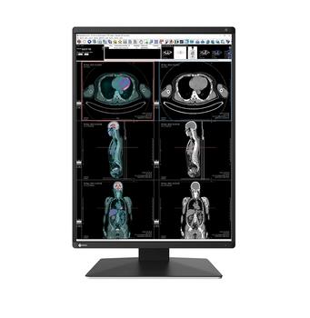 EIZO 3MP COLOR 21.3 EIZO RADIFORCE RX370 1536X2048 500CD MNTR (RX370)