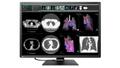 EIZO 12MP EIZO RADIFORCE RX1270 31IN MAMMOGRAPHY SELFQC MNTR