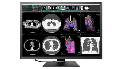 EIZO 12MP EIZO RADIFORCE RX1270 31IN MAMMOGRAPHY SELFQC MNTR (RX1270)