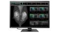 EIZO 12MP EIZO RADIFORCE RX1270 31IN MAMMOGRAPHY SELFQC MNTR (RX1270)