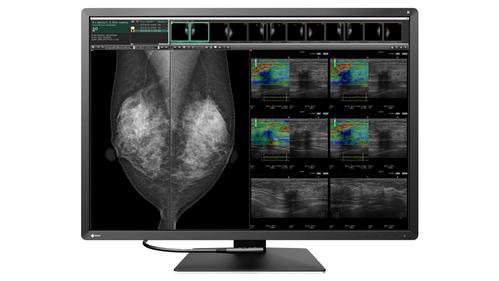 EIZO 12MP EIZO RADIFORCE RX1270 31IN MAMMOGRAPHY SELFQC MNTR (RX1270)