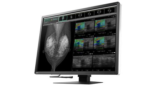 EIZO 12MP EIZO RADIFORCE RX1270 31IN MAMMOGRAPHY SELFQC MNTR (RX1270)