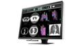 EIZO 12MP EIZO RADIFORCE RX1270 31IN MAMMOGRAPHY SELFQC MNTR (RX1270)