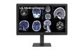 LG 31,5"" Medical 32HQ713D-B Diagnostic Monitor | 3840x2160 | IPS | 14ms | 60Hz | 5Ã¥r | BestÃ¤llningsvara
