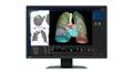 EIZO 2.3MP RADIFORCE MX243W 24IN DIAGNOSTIC DISPLAY MNTR