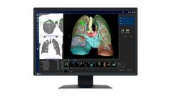 EIZO 2.3MP RADIFORCE MX243W 24IN DIAGNOSTIC DISPLAY MNTR