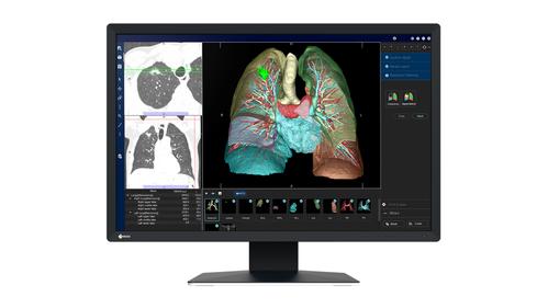 EIZO 2.3MP RADIFORCE MX243W 24IN DIAGNOSTIC DISPLAY MNTR (MX243W)