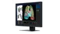EIZO 2.3MP RADIFORCE MX243W 24IN DIAGNOSTIC DISPLAY MNTR (MX243W)
