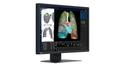 EIZO 2.3MP RADIFORCE MX243W 24IN DIAGNOSTIC DISPLAY MNTR (MX243W)