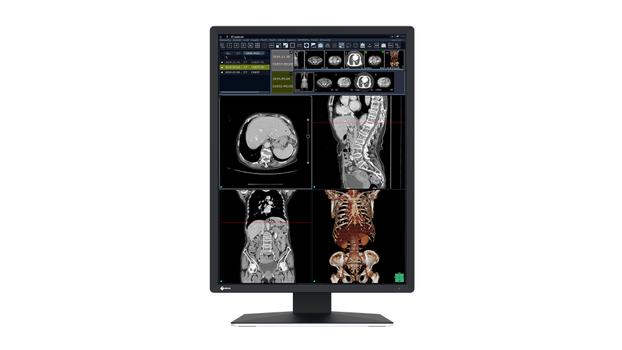 EIZO RX270 RADIFORCE HIGH CONTRAST 2MP MONITOR FOR GREYSCALE AND CO MNTR (RX270)