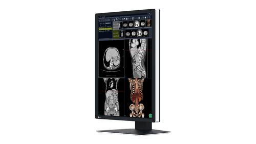 EIZO RX270 RADIFORCE HIGH CONTRAST 2MP MONITOR FOR GREYSCALE AND CO MNTR (RX270)