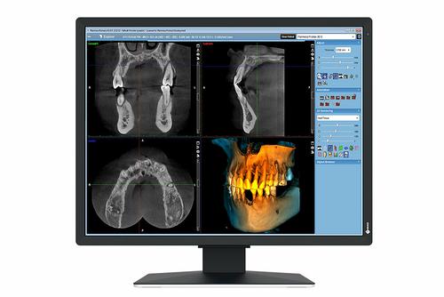 EIZO 2MP EIZO RADIFORCE MX217-SB 21IN DIAGNOSTIC DISPLAY SELFQC MNTR (MX217-SB)