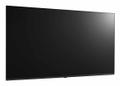 LG 50UM662H0LC Smart FHD Hotel TV (50UM662H0LC)