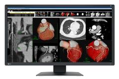 EIZO 8MP EIZO RADIFORCE MX317W 31IN DIAGNOSTIC SELFQC USB-C 90W PD MNTR