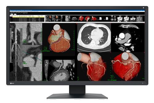 EIZO 8MP EIZO RADIFORCE MX317W 31IN DIAGNOSTIC SELFQC USB-C 90W PD MNTR (MX317W)