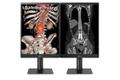 LG 21,3"" Medical 21HQ513D-S | Diagnostic Monitor | 1536x2048 | IPS | 5ms | 60Hz | 5Ã¥r | BestÃ¤llningsvara (21HQ513D-S)