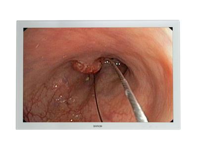 BARCO "MDSC-2124 24"" Surgical Display" (K9304111)