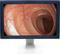 OLORIN MedicLine ML240D 24" TFT