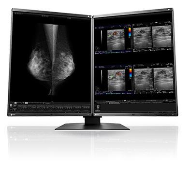EIZO 5MP 21 IN LED-TFT 1100 CD/QM 5 YEARS WARRANTY MNTR (RX560)